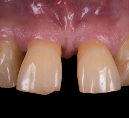 Before Image